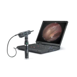 Otoscopio Digital MacroView™