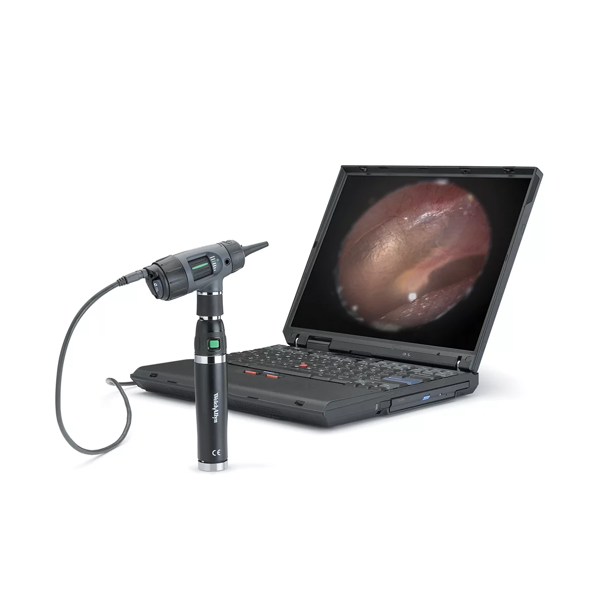 Otoscopio Digital MacroView™